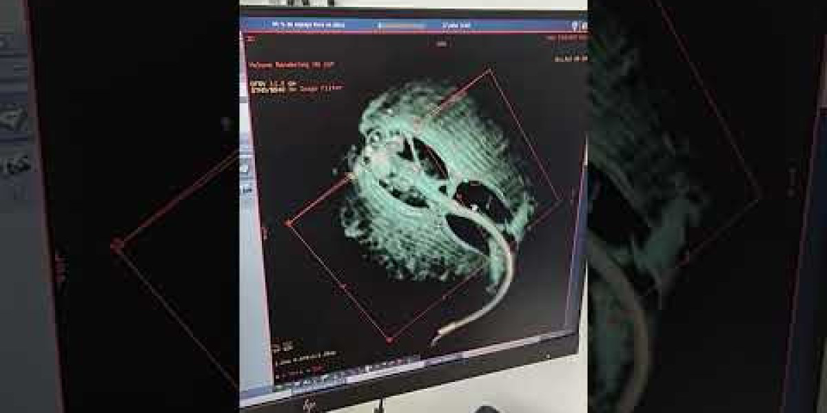 Echocardiogram: What It Shows, Purpose, Types, and Results